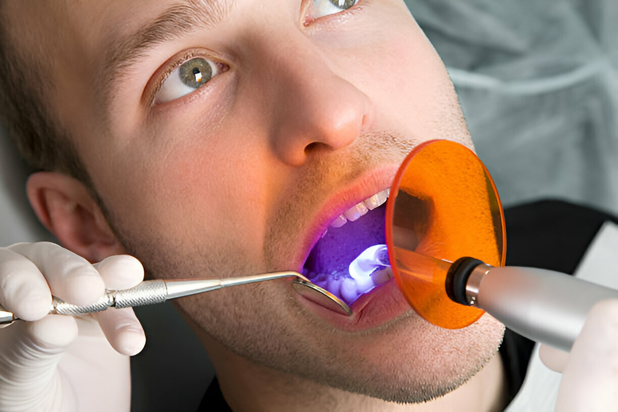 The Benefits of Teeth Whitening at Heritage Dental in San Antonio, Texas_1